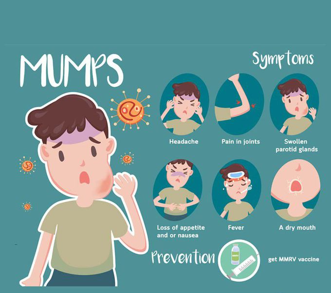 Symptoms of Mumps