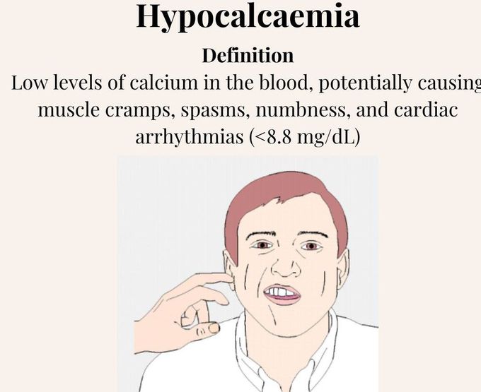 Hypocalcemia I