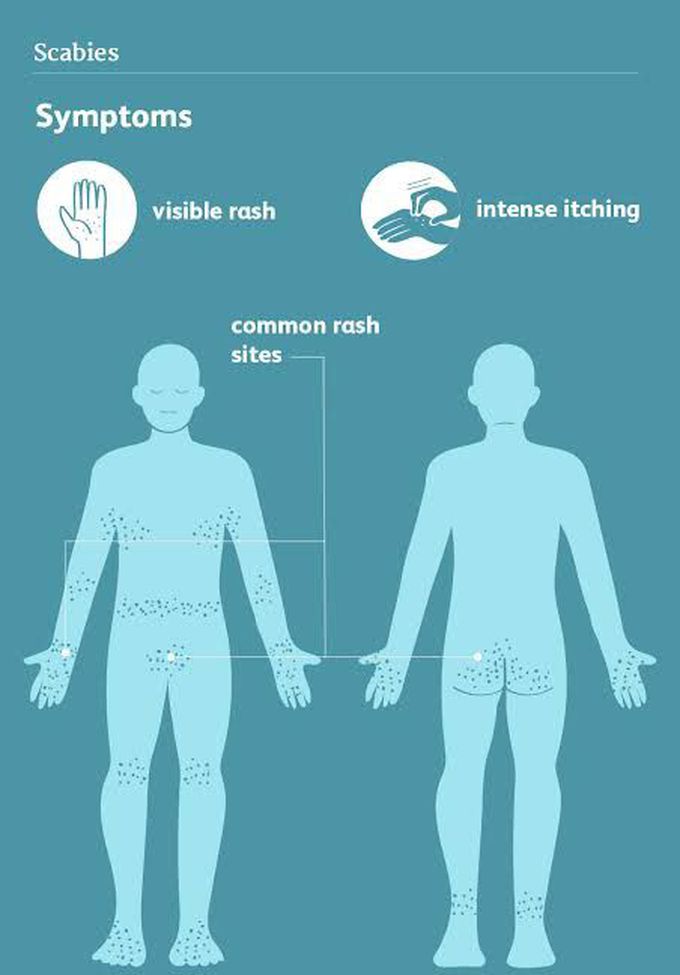 Symtoms of scabies