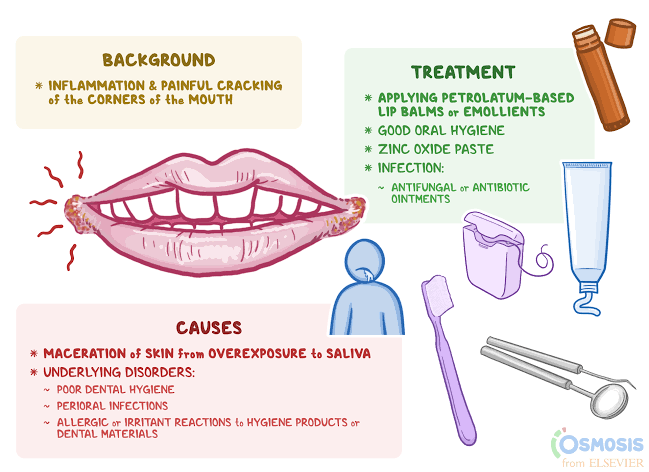 Causes of angular cheilitis - MEDizzy