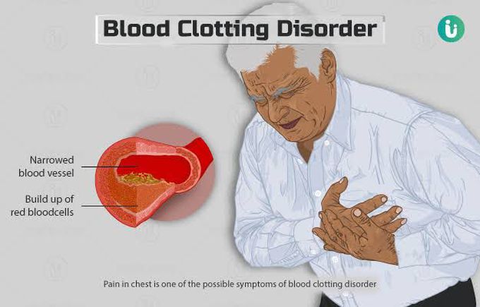 Treatment of blood clotting disorder