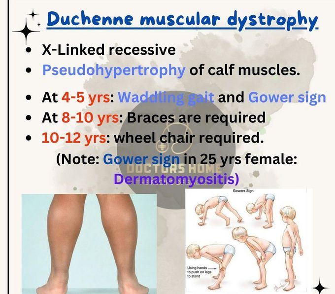 Duchenne Muscular Dystrophy