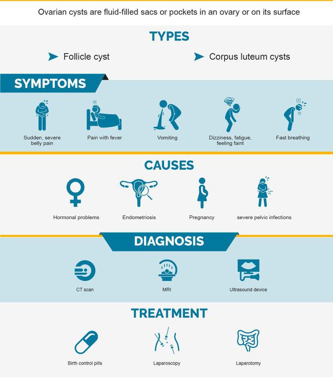 Treatment for Ovarian torsion