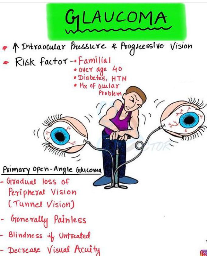 Glaucoma