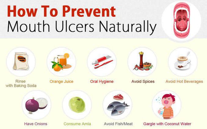 This is how to prevent Mouth Ulcers naturally.