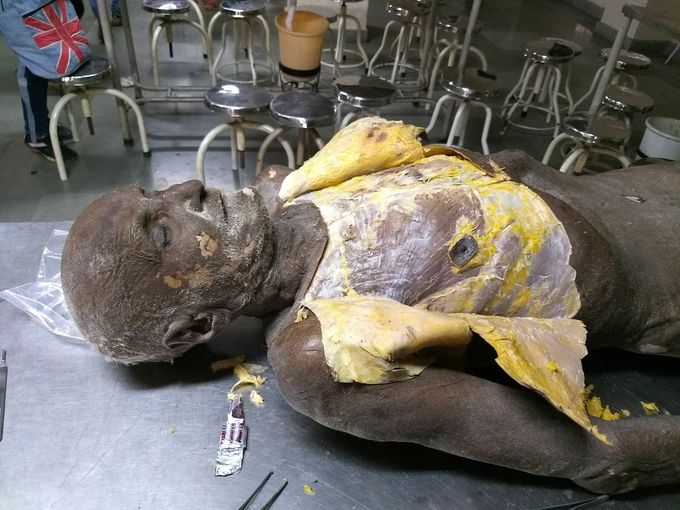 Dissection