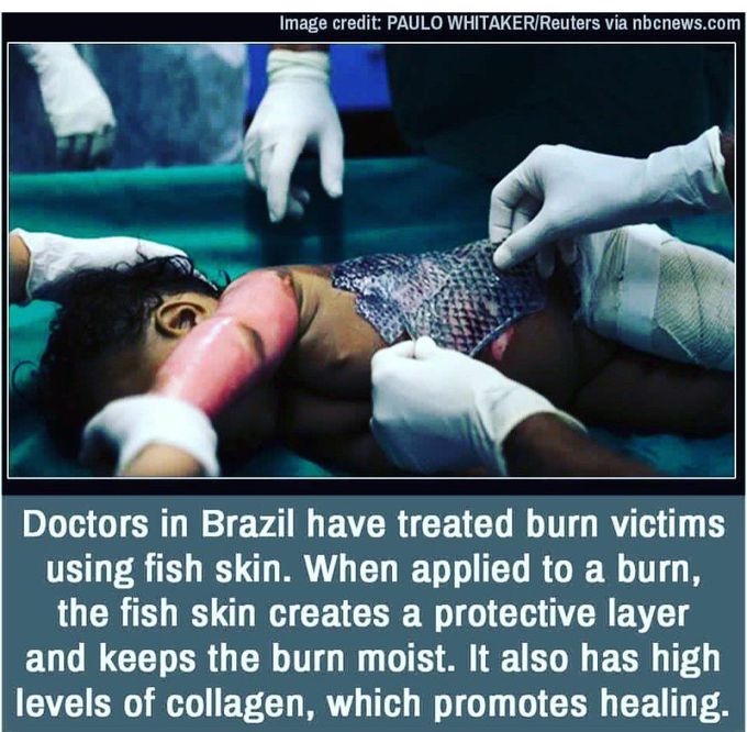 👏techniques@Brazil