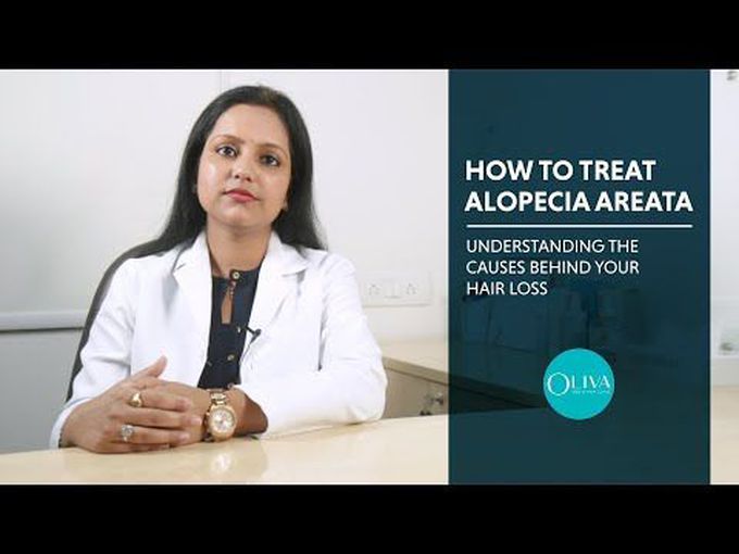 Alopecia Areata (Cause, Symptoms and pharmacological Treatment)