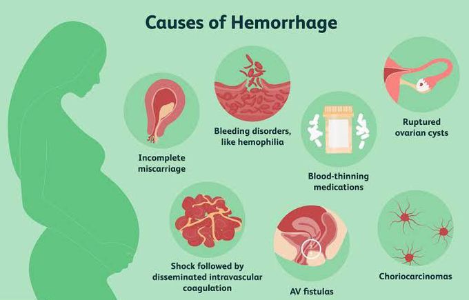 Causes and signs of hemorrhage