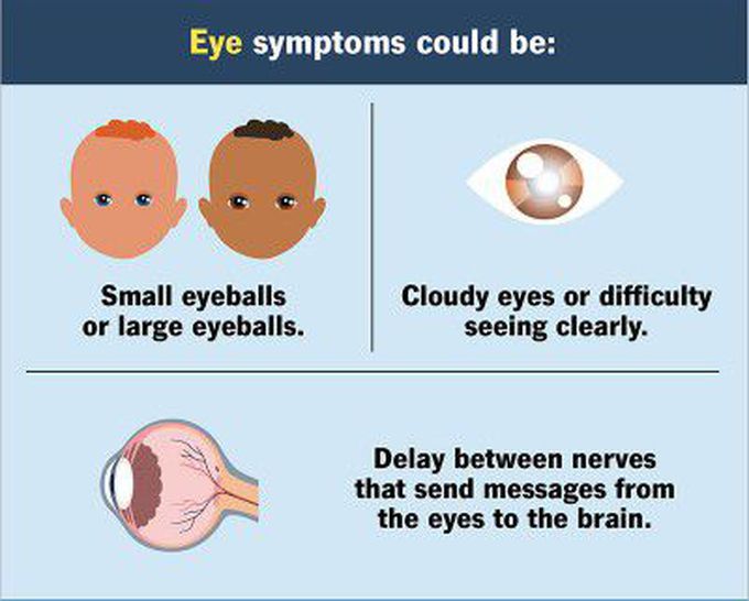 These are the eye symptoms of Walker warburg syndrome