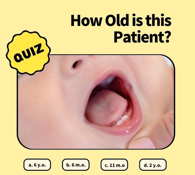 Identify the Age
