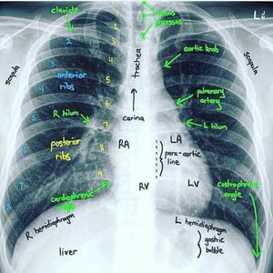 X Ray determination - MEDizzy