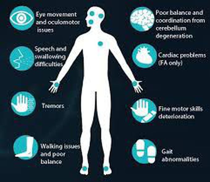 Symptoms of ataxia