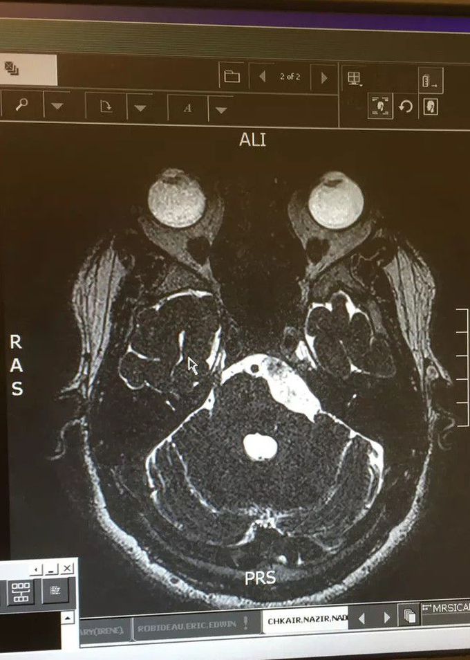 Neurosurgery