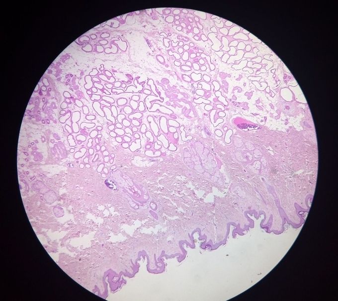 Histología: Piel fina