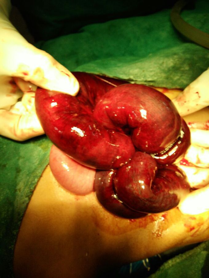 What is diagnosis......?
