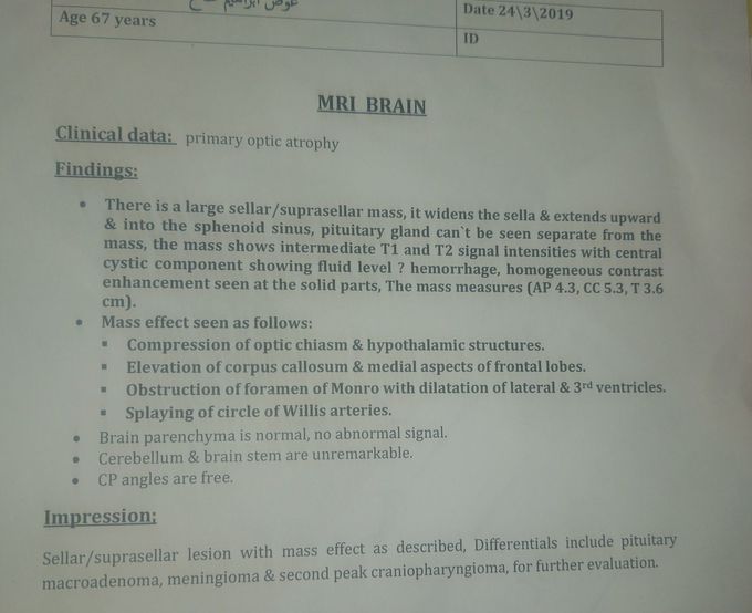 MRI brain report of 67 years man