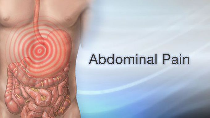 Types of abdominal pain