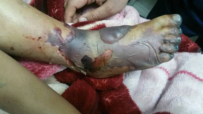 Spot the diagnosis
