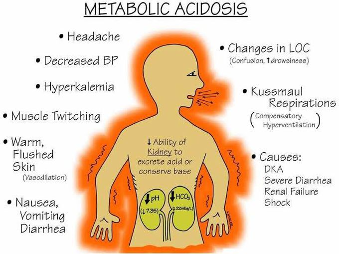 Metabolic Acidosis