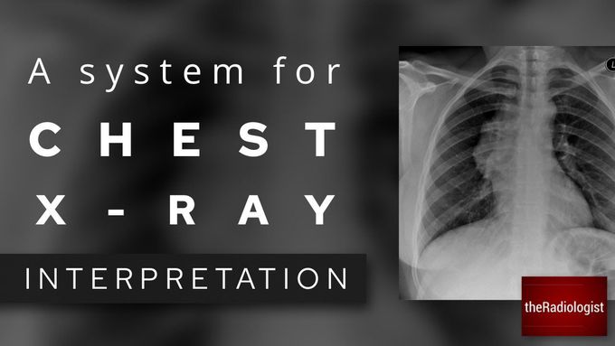 A System for Chest X-Ray Interpretation: going through my review areas