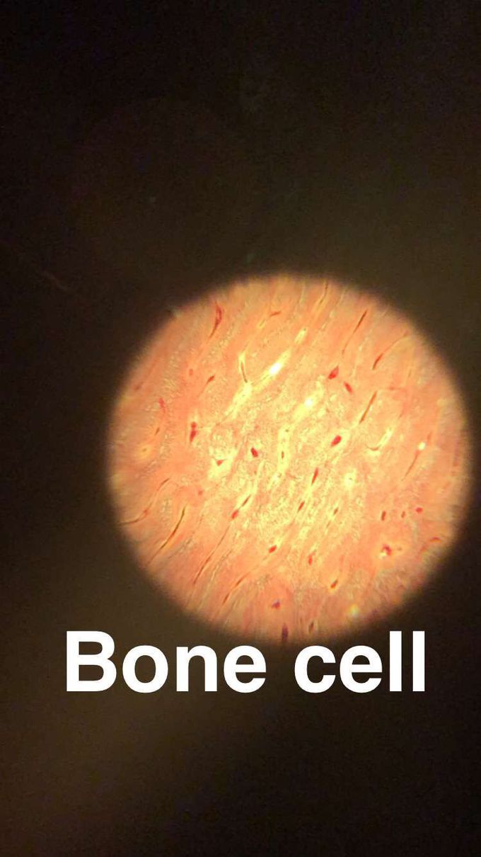 Bone cell