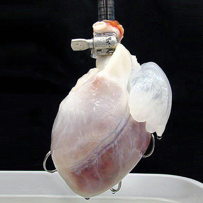 Decellularized heart with the vascular system still intact