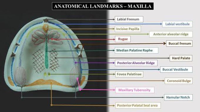 Anatomical review of Maxilla