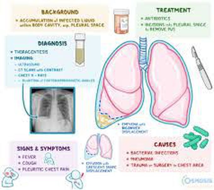 Cause of empyema