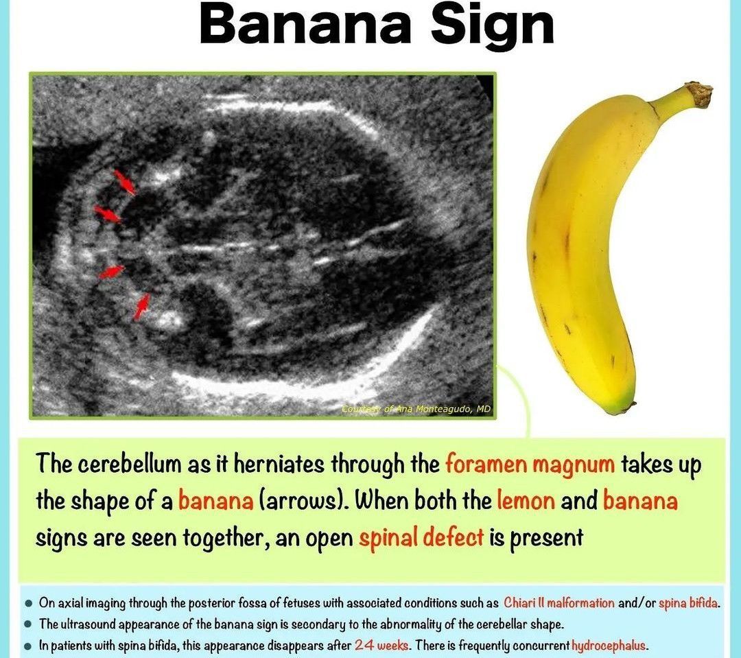 Banana Sign MEDizzy