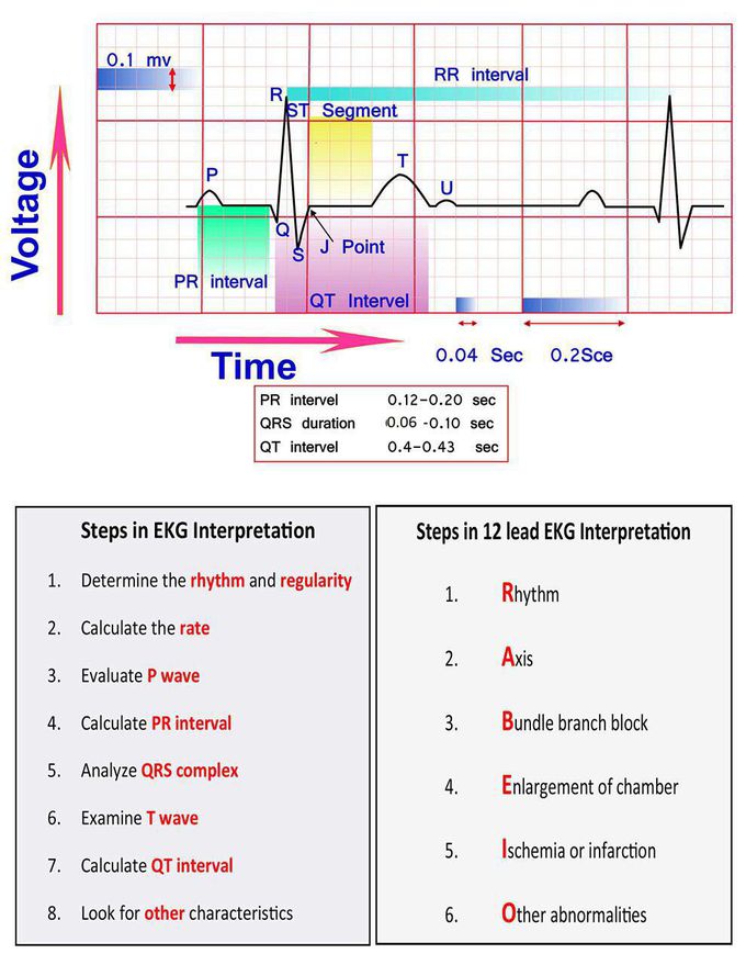 ECG interpretation