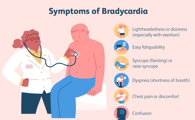 Symptoms of Sinus bradycardia