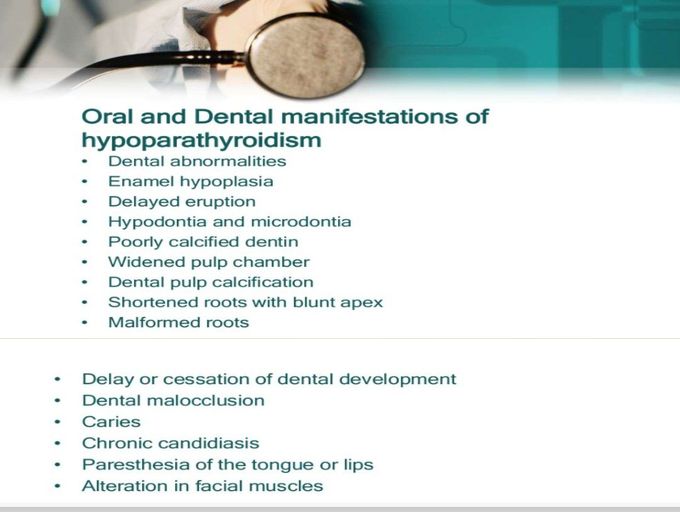 Hypoparathyroidism-Oral Manifestions