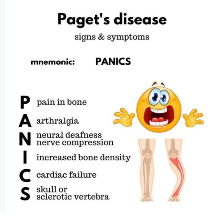 Pagets disease of bone