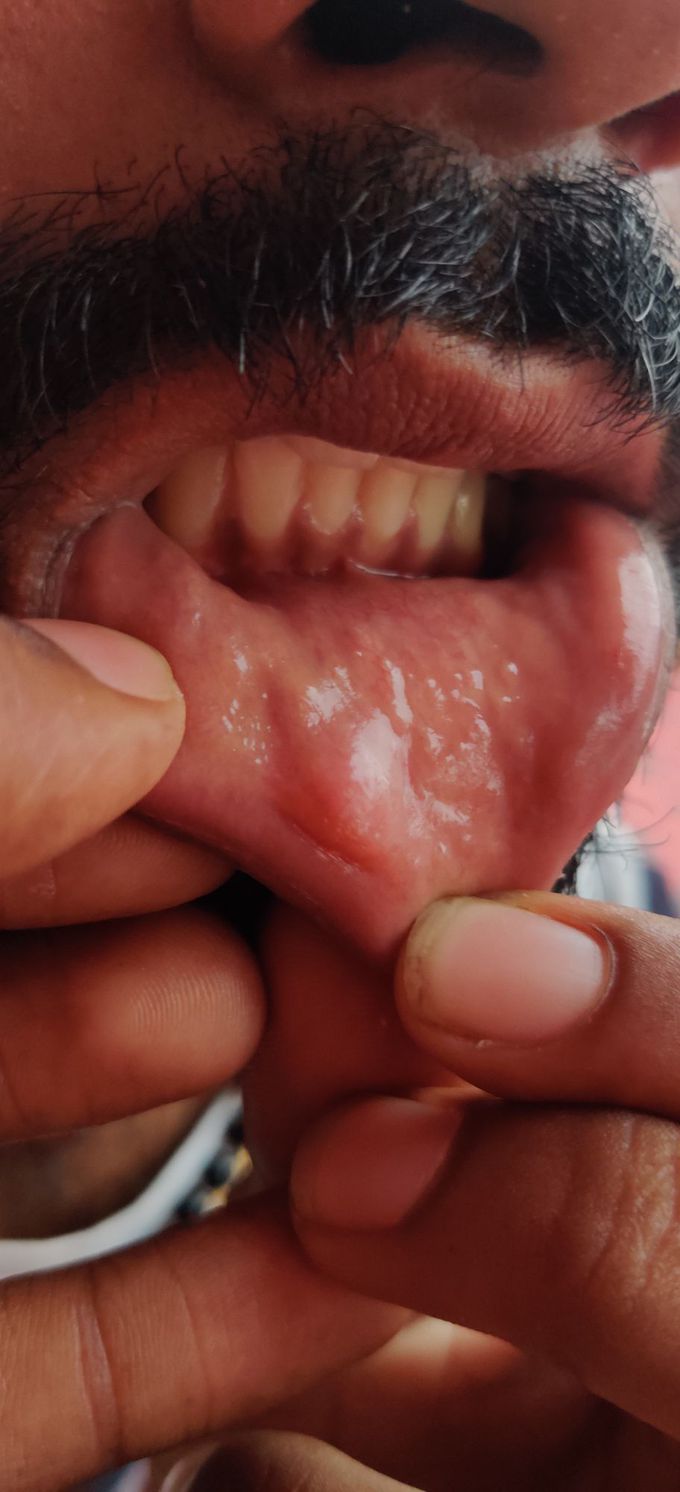 Diagnosis??