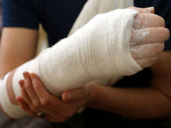Experimental glue could soon fix broken bones