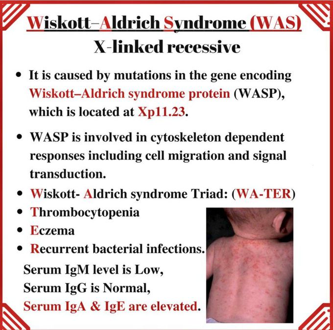 Wiskott Aldrich Syndrome