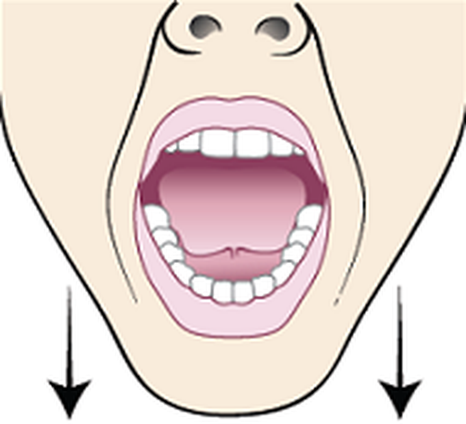 Treatment of Trismus