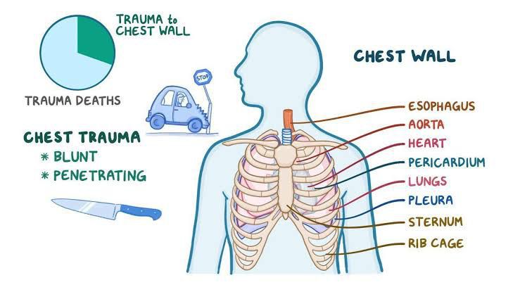 Flail Chest Symptoms Medizzy