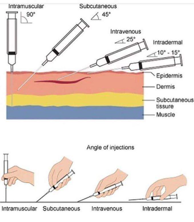 Angles Of Injections in the skin layers