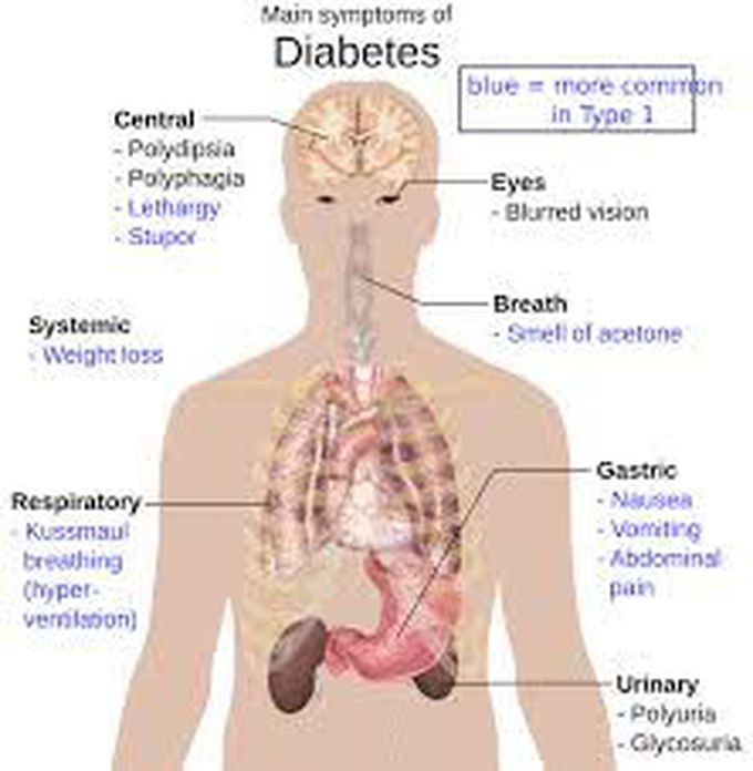 Diabetes