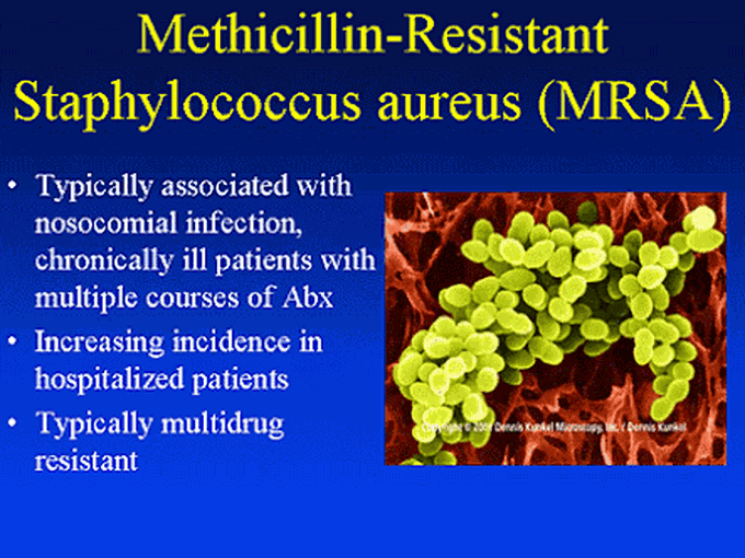 MRSA