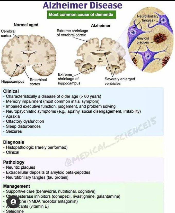 Alzheimers Disease - MEDizzy