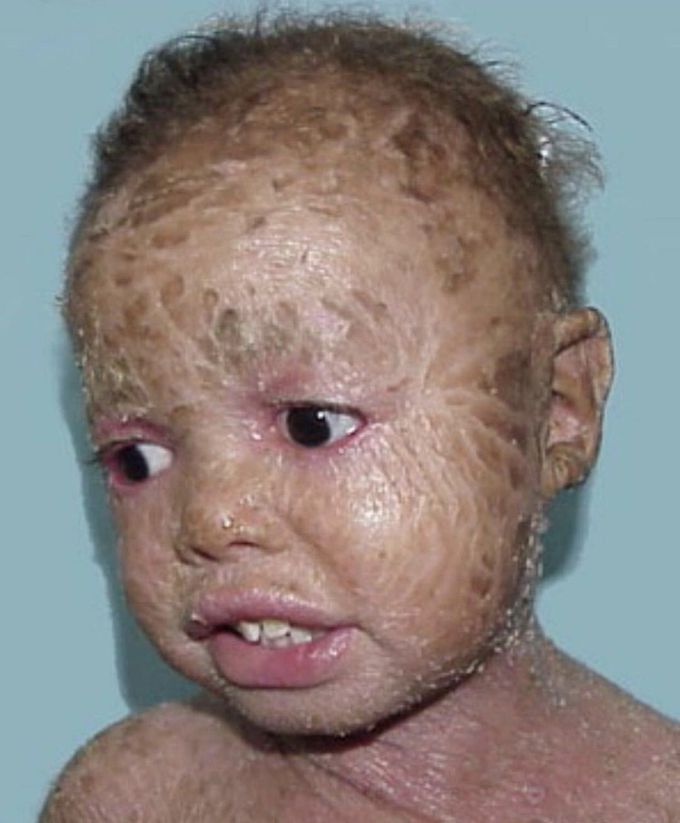 Doctorss whts the diagnosis ??