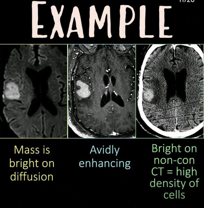 How to Read MRI X