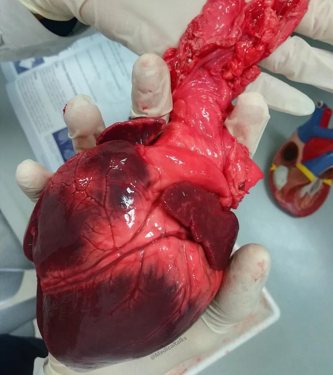 The Heart