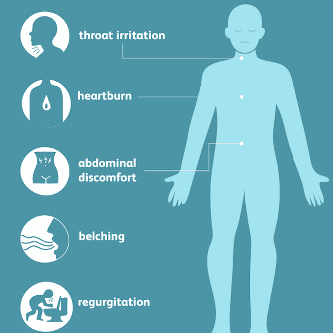Symptoms of hiatal hernia