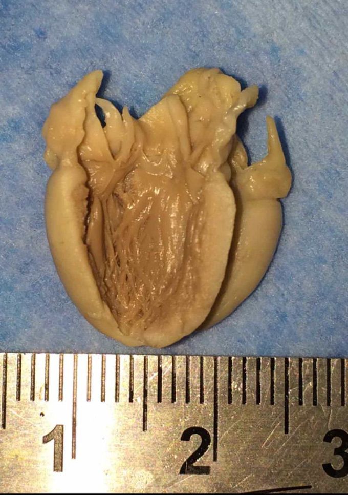 Heart of the Embryo