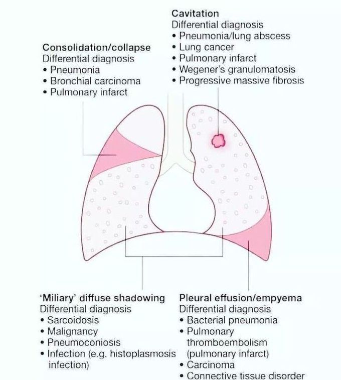 Pathological condition of lungs