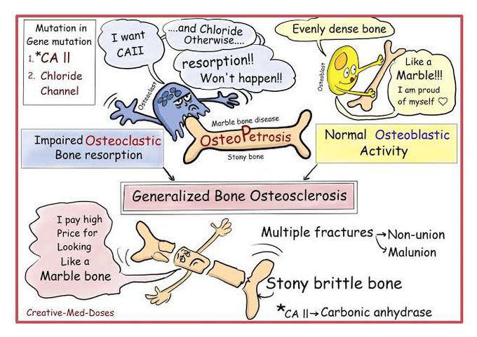 Osteopetrosis